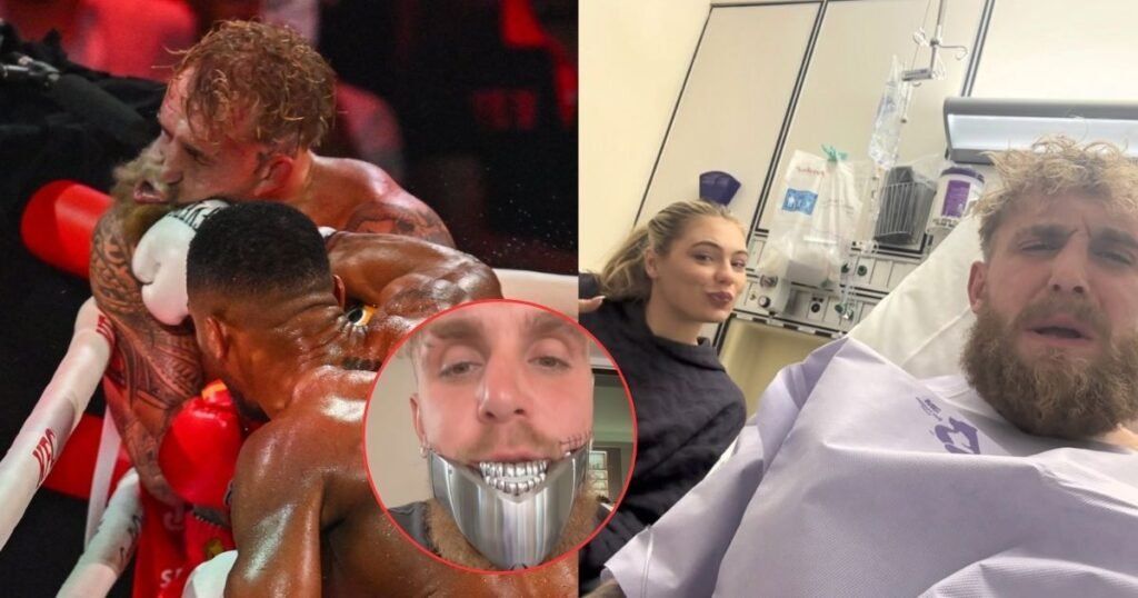 Jake Paul gets second surgery
